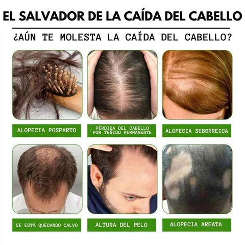 Serum 7 Days Para el Crecimiento de tu cabello - 7 DAYS - ENVIO GRATIS